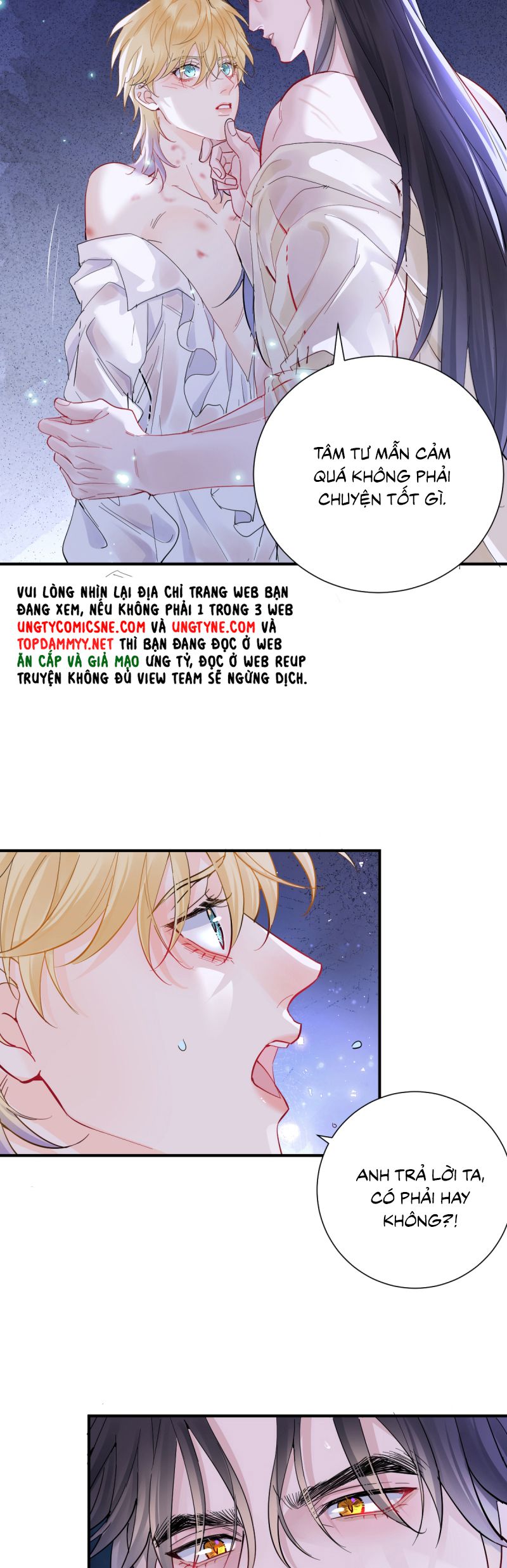 Bản Tình Ca Nụ Hôn Tù Ái Chap 35 - Next Chap 36
